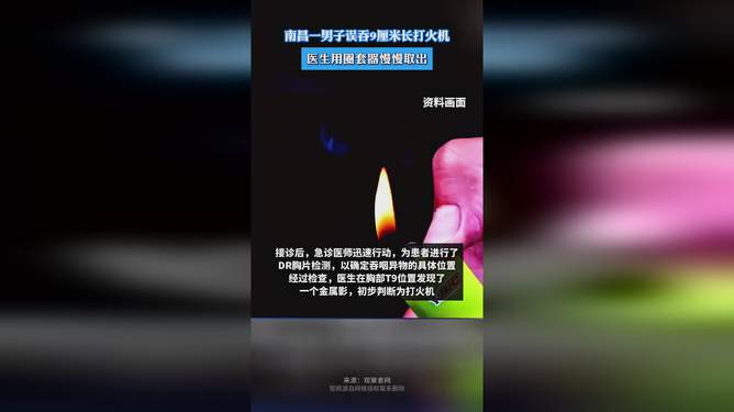 男子误吞9cm打火机，一次惊险的医疗救援经历_解答解释