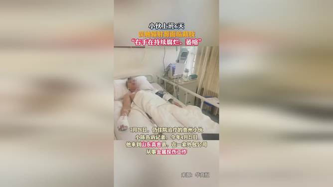 小伙误触辐射源，手腐烂萎缩的警示故事