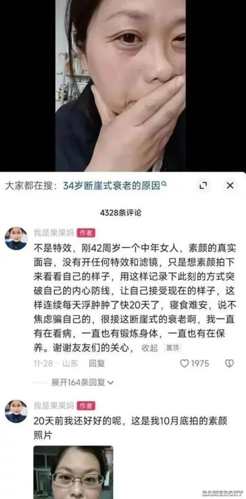 女生确诊渐冻症容貌巨变，母亲回应，爱与勇气并存的力量